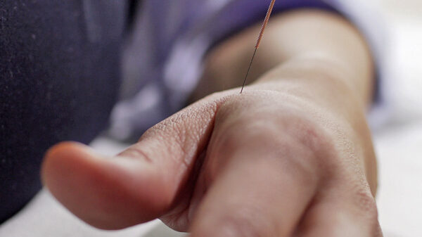 Spitzenmedizin - Film